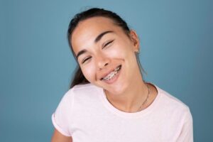Clear Aligner Misconceptions