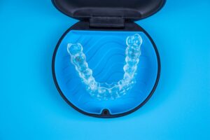 Invisalign Clear Aligners Review