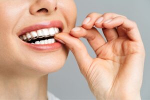 Oral Care with Braces or Clear Aligners