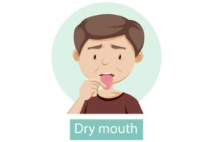 Dental Care Solutions for Dry Mouth