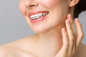 Myths and Facts about Orthodontic Treatments