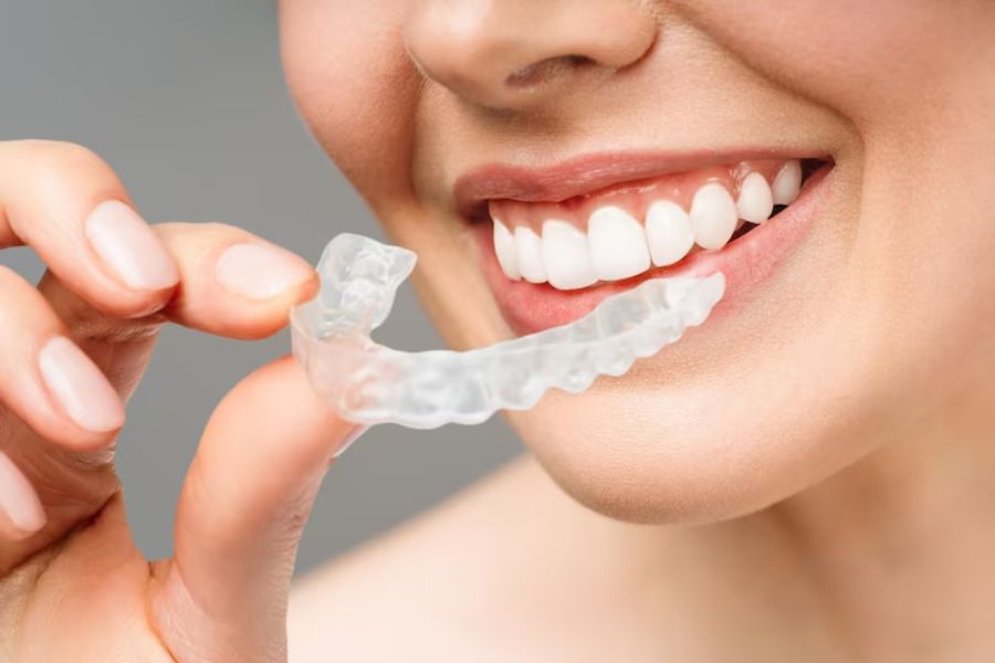 Comparing Clear Aligner Brands