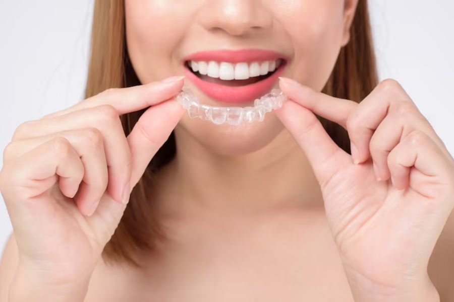 Comparing Clear Aligner Providers