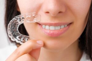 Role of Chewies in Clear Aligner Treatment