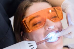 Post Teeth Whitening Care