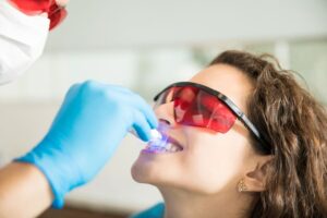 Side Effects of Teeth Whitening